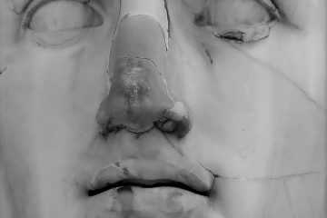 getting injured care of your skin mental health Knowledge Rhinoplasty gray statue of man