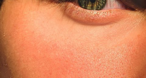 natural skin beauty routine Color contact lenses Glaucoma Eyelash Extension autism diagnosis Skin Mental health Divorce Drugs Skincare Routine persons eye in close up