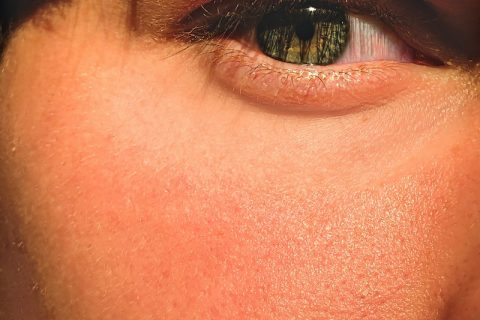 Skincare Routine persons eye in close up